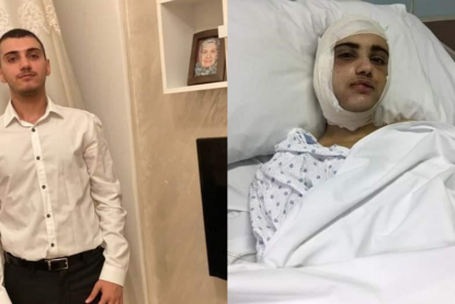 التلميذ محمد اسماعيل ينتصر على الموت في 4 آب ويحرز تقديرًا في الإمتحانات الرسمية بعد فترة علاج قاسية